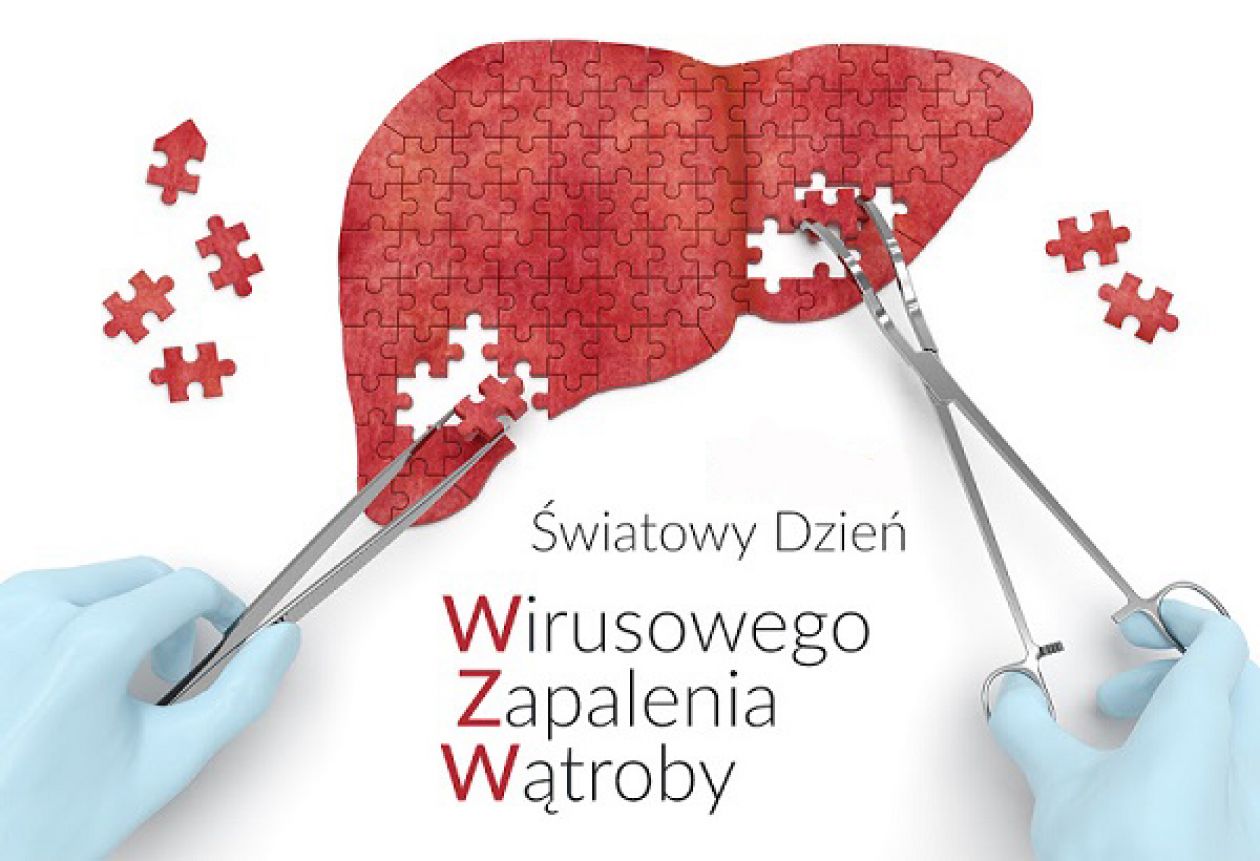Sprawdź swoją wątrobę - bezpłatne badania w ŚCO