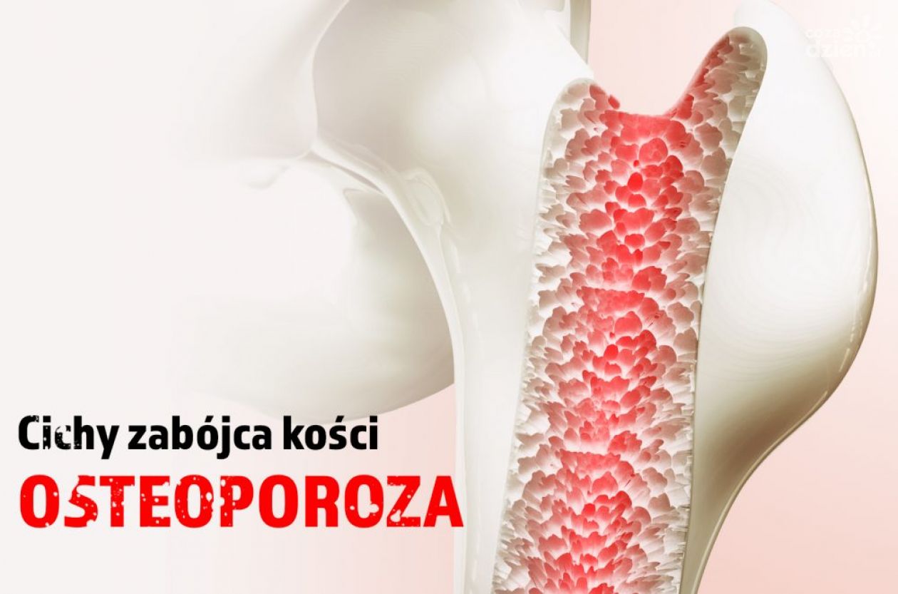 Osteoporoza - cichy złodziej kości 