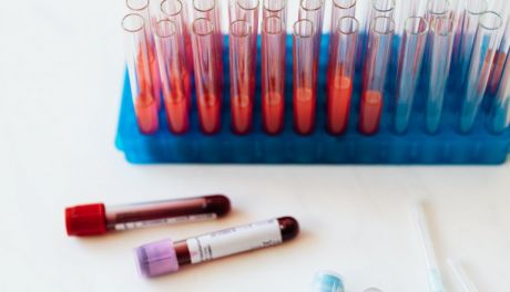 Pilnie potrzebna krew – Regionalne Centrum Krwiodawstwa w Kielcach apeluje do mieszkańców