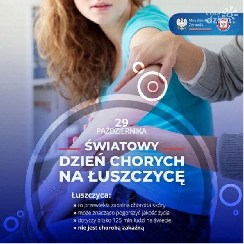 Łuszczyca – choroba przewlekła, ale nie zakaźna