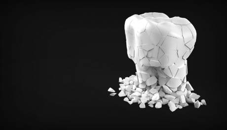 Co warto wiedzieć o implantach i leczeniu kanałowym?