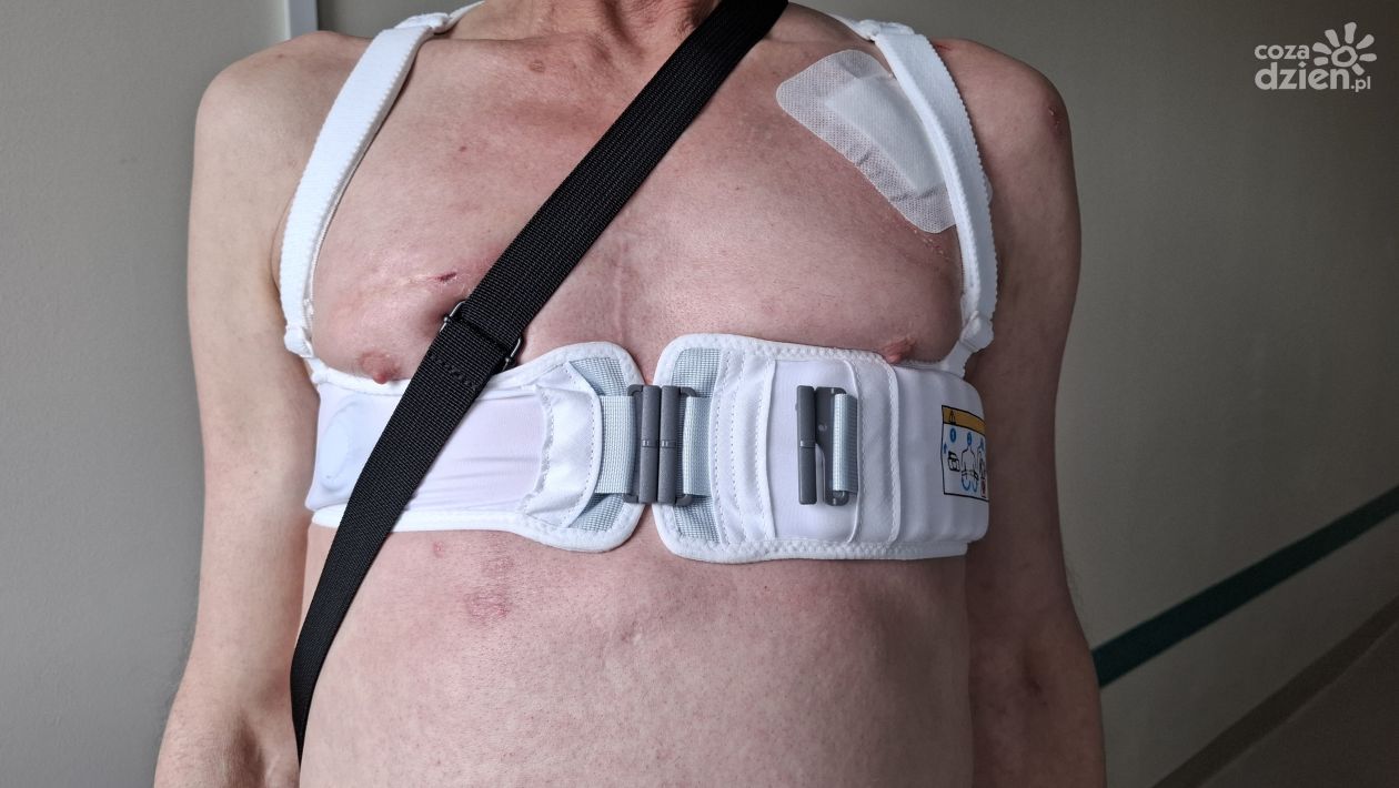 Kamizelka defibrylująca ratuje życie pacjentowi starachowickiej lecznicy