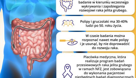 W województwie świętokrzyskim rozpoczął się bezpłatny program badań przesiewowych w kierunku raka jelita grubego